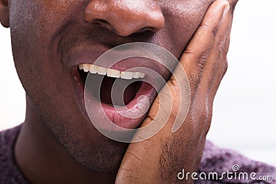 Man Having Toothache Stock Photo