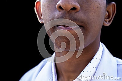 Close-up of man lips suffering from herpes disease Stock Photo