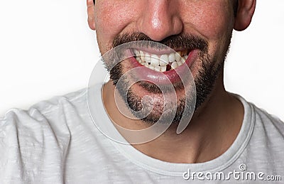 Man Missing Tooth Stock Photo