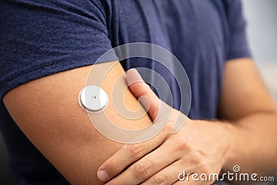 Man Testing Glucose Level With A Continuous Glucose Monitor Stock Photo
