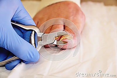 Close-up of a manicurist with pedicure pliers trimming old person toenail. Stock Photo