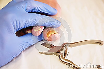 Close-up of a manicurist with pedicure pliers trimming old person toenail. Stock Photo