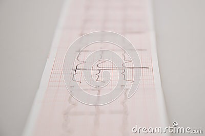 Close up. Medical research. ECG Tape with mild arrhythmia. Stock Photo