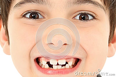 Close Up Missing Teeth Stock Photo