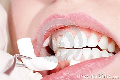Close-up mouth and teeth Stock Photo