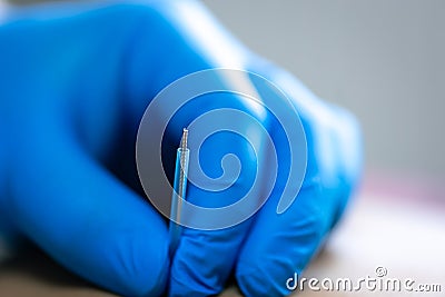 Close up of a needle and hands of physiotherapist doing a dry needling. Stock Photo