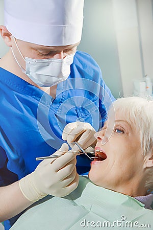 Close-up of open mouth during oral checkup at the dentist's Stock Photo