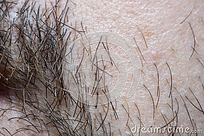 A close-up of a part of male skin with partially shaved facial hair Stock Photo