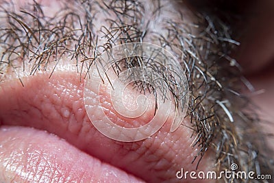 A close-up of a part of male skin with partially shaved vegetation on the face and lips with a strong magnification under a micros Stock Photo