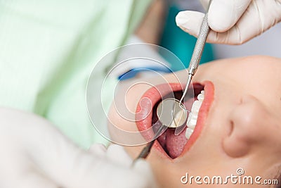 Close-up of patient open mouth during oral inspection Stock Photo