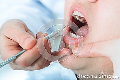 Close-up of patients open mouth during oral Stock Photo