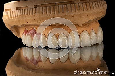 Close-up photo of a dental upper jaw prosthesis on black glass background. Artificial jaw with veneers and crowns. Tooth Stock Photo