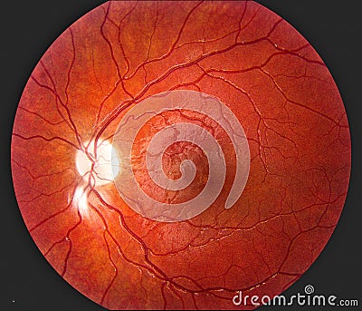 human eye retina showing blood vessels Stock Photo