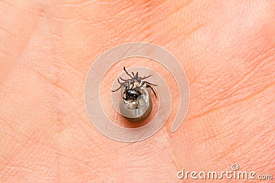 Close-up photo of a tick couple male and female on human skin Stock Photo