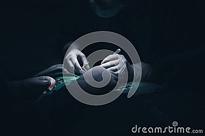 Close up picture of a young patient`s hand while the doctors inject the anestetic agent before surgical intervention in a dark, cr Stock Photo