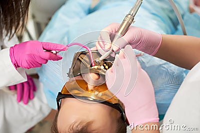 Close-up polishing teeth patient using cofferdam. Dental services in clinic Stock Photo