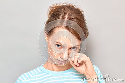 Portrait of sad tearful girl with white drops of face cream on skin Stock Photo