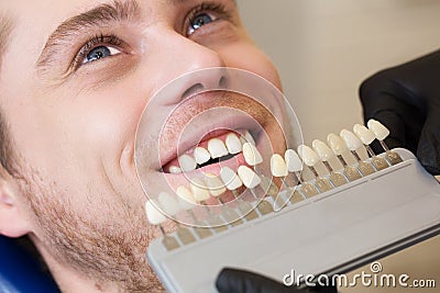 Close up portrait of Young man in dentist chair, Check and select the color of the teeth. Dentist makes the process of treatment i Stock Photo