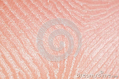 Close-up skin with sebaceous secretions on human leg, macro Stock Photo