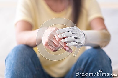 Close up two hands of woman with disability bionic arm, person lost her arm, disabled cyborg girl artificial prosthetic Stock Photo