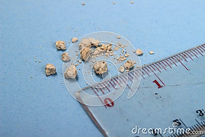 Very small kidney stones with ruler at blue background Stock Photo