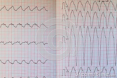 Close up view of an electrocardiogram paper, graphic Stock Photo