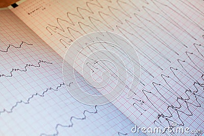 Close up view of an electrocardiogram paper, graphic Stock Photo
