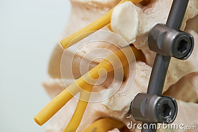 Close-up view of lumbar spine model and instrument fixation Stock Photo