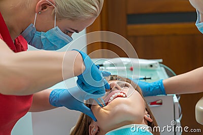 Close-up woman with ceramic braces on teeth at the dental office. Dentist holding dental tool - corner ligature cutters. Orthodont Stock Photo