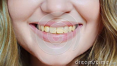 close-up. a woman's smile with yellow teeth. Stock Photo