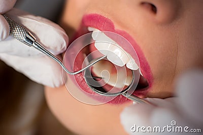 Close up of young woman having dental check up in dental office. Dentist examining a patient`s teeth with dental tools Stock Photo