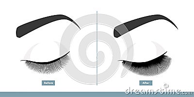 Closed Eye Before and After Eyelash Extension. Comparison of Natural vs. Volume Eyelashes. Infographic Vector Vector Illustration