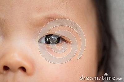 Closeup Asian infant baby eye Stock Photo