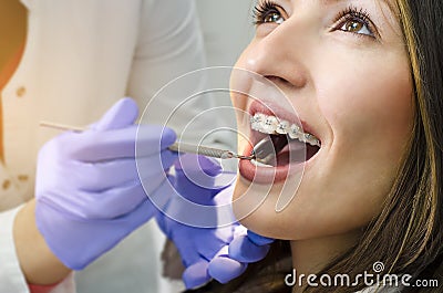 Closeup of beautiful girl on dental braces check up Stock Photo