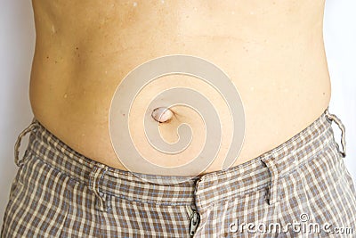 Closeup bulge navel. Stock Photo