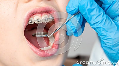 Dentist using an instrument to visualize the teeth of a child patient Stock Photo