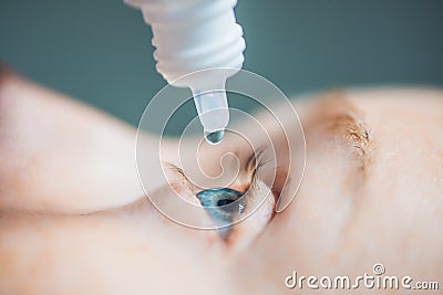 Closeup of eyedropper putting liquid into open eye Stock Photo