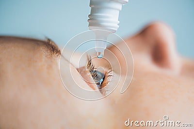 Closeup of eyedropper putting liquid into open eye Stock Photo