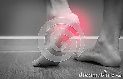 Closeup of a female foot heel pain with red spot, plantar fasciitis Stock Photo