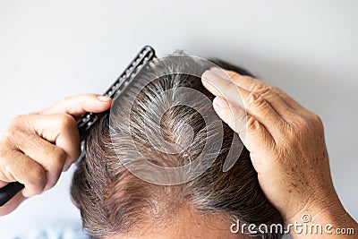 Closeup Hair grows on the head of an old woman Stock Photo