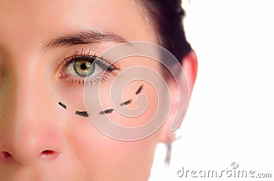 Closeup half of face caucasian woman with dotted lines drawn around left eye, preparing cosmetic surgery Stock Photo