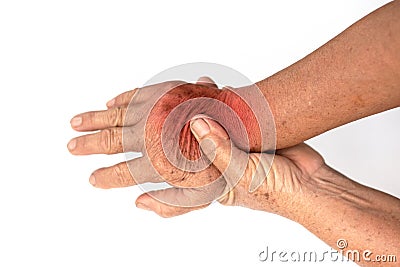 Closeup Hands on the pain of old women. Stock Photo
