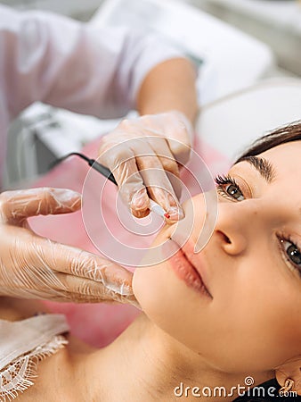 Closeup image of dermatologist& x27;s hands doing electro-epilation. The process of electrolysis on the face. Beauty Stock Photo