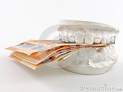 Closeup kid orthodontic dental impression chalk model biting euro money on white background Stock Photo