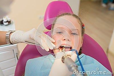 Closeup of little girl opening mouth wide during dental treatment of oral cavity. Stock Photo