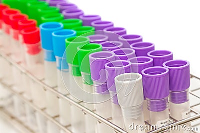 Closeup medical Blood tube, test tube Stock Photo