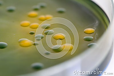 Closeup for plate Bacteria culture growth on Selective media Stock Photo