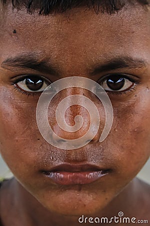 Closeup of a poor staring hungry orphan boy in a refugee camp with sad expression. Editorial Stock Photo