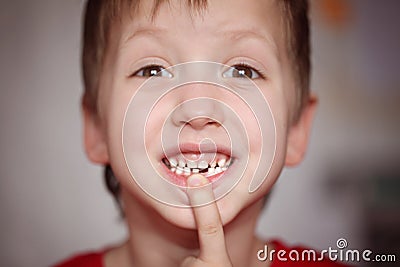 Closeup portrait Little happy boy proud to loose his milk tooth Stock Photo