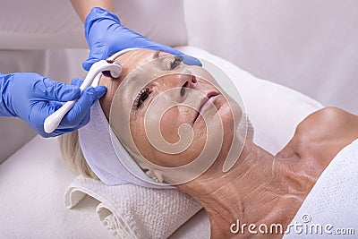 Closeup shot of a beautiful female in beauty salon during mesotherapy procedure with derma roller Stock Photo